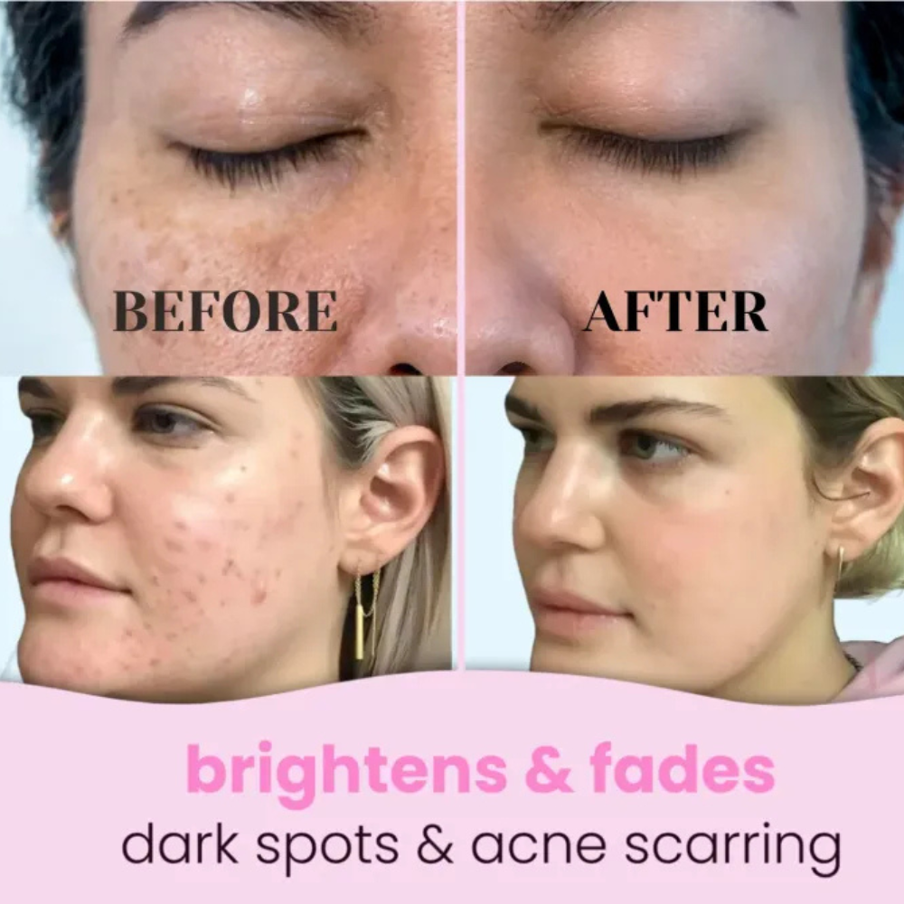 Limpiador facial de cúrcuma