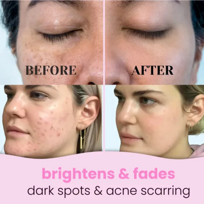 Limpiador facial de cúrcuma