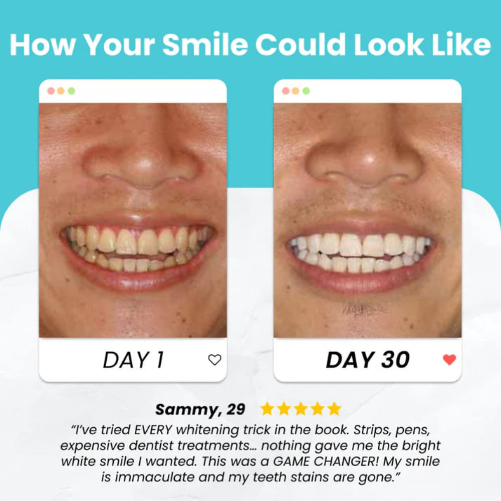 360° Whitening Toothbrush